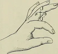 An illustration from Die Röntgentechnik : Lehrbuch für Ärzte und Studierende (1906)