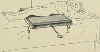 Picture 142 of 145 from Die Röntgentechnik : Lehrbuch für Ärzte und Studierende (1906), leaf 426