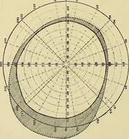 An illustration from Die Suggestion und ihre Heilwirkung (1888)