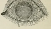 An illustration from Diseases of the eye. (1890)