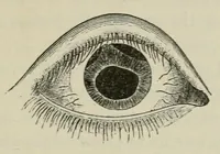 An illustration from Diseases of the eye. (1890)
