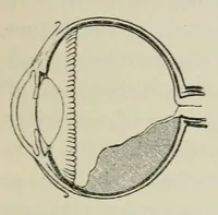 An illustration from Diseases of the eye. (1890)
