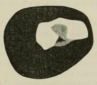An illustration from Diseases of the eye. (1890)