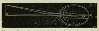 Picture 13 of 18 from Diseases of the eye. (1890), leaf 330