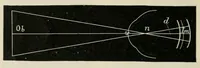 Picture 3 of 18 from Diseases of the eye. (1890), leaf 40