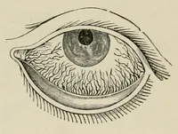 An illustration from Diseases of the eye. (1890)