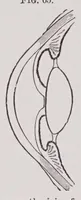 An illustration from Diseases of the eye (1900)
