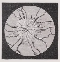 An illustration from Diseases of the eye (1900)