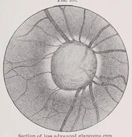 An illustration from Diseases of the eye (1900)