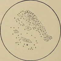 An illustration from Diseases of the stomach : a text-book for practitioners and students (1906)