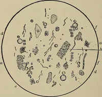 An illustration from Diseases of the stomach : a text-book for practitioners and students (1906)