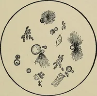 An illustration from Diseases of the stomach : a text-book for practitioners and students (1906)