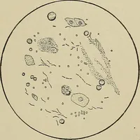 An illustration from Diseases of the stomach : a text-book for practitioners and students (1906)