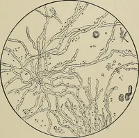 An illustration from Diseases of the stomach : a text-book for practitioners and students (1906)