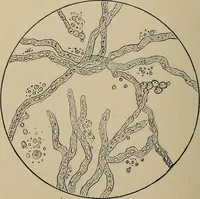 An illustration from Diseases of the stomach : a text-book for practitioners and students (1906)