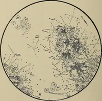 An illustration from Diseases of the stomach : a text-book for practitioners and students (1906)
