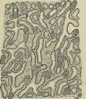 An illustration from Diseases of the stomach : a text-book for practitioners and students (1906)