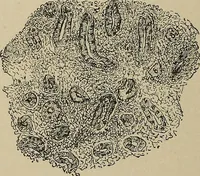 An illustration from Diseases of the stomach : a text-book for practitioners and students (1906)