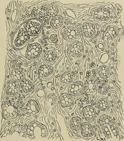 An illustration from Diseases of the stomach : a text-book for practitioners and students (1906)