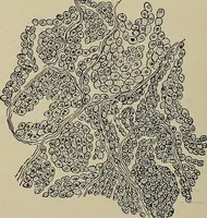 An illustration from Diseases of the stomach : a text-book for practitioners and students (1906)