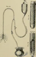 An illustration from Diseases of the stomach : a text-book for practitioners and students (1906)