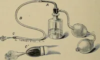 An illustration from Diseases of the stomach : a text-book for practitioners and students (1906)