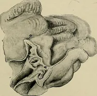 An illustration from Diseases of the stomach : a text-book for practitioners and students (1906)