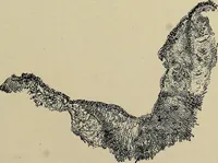 An illustration from Diseases of the stomach : a text-book for practitioners and students (1906)