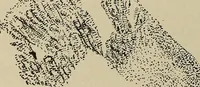 An illustration from Diseases of the stomach : a text-book for practitioners and students (1906)