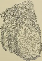 An illustration from Diseases of the stomach : a text-book for practitioners and students (1906)