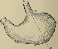 An illustration from Diseases of the stomach : a text-book for practitioners and students (1906)