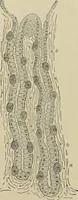 An illustration from Diseases of the stomach : a text-book for practitioners and students (1906)