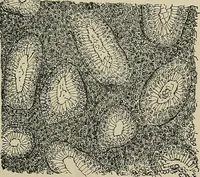 An illustration from Diseases of the stomach : a text-book for practitioners and students (1906)