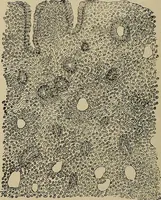 An illustration from Diseases of the stomach : a text-book for practitioners and students (1906)