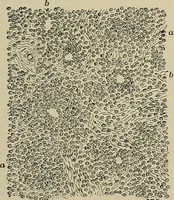 An illustration from Diseases of the stomach : a text-book for practitioners and students (1906)