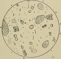 An illustration from Diseases of the stomach : a text-book for practitioners and students (1906)