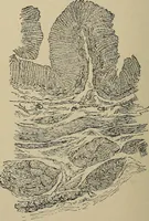 An illustration from Diseases of the stomach : a text-book for practitioners and students (1906)