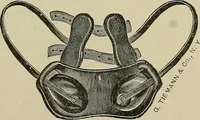 An illustration from Diseases of the stomach : a text-book for practitioners and students (1906)