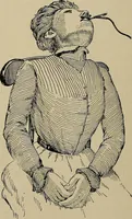 An illustration from Diseases of the stomach : a text-book for practitioners and students (1906)