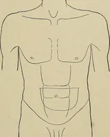 An illustration from Diseases of the stomach : a text-book for practitioners and students (1906)