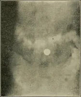 An illustration from Diseases of the stomach : a text-book for practitioners and students (1906)