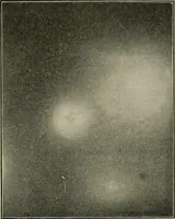 An illustration from Diseases of the stomach : a text-book for practitioners and students (1906)