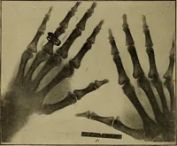 An illustration from Electricity and its recent applications (1902)