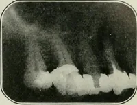 An illustration from An elementary book on electricity and magnetism and their applications (1919)