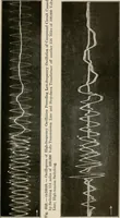 An illustration from Elementary lectures on electric discharges, waves and impulses, and other transients (1914)
