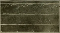 An illustration from Elementary lectures on electric discharges, waves and impulses, and other transients (1914)