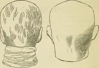 Picture 18 of 45 from Elements of phrenology (1850), leaf 76