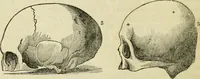 Picture 20 of 45 from Elements of phrenology (1850), leaf 80
