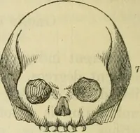 Picture 25 of 45 from Elements of phrenology (1850), leaf 92