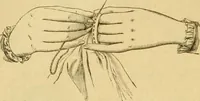 An illustration from Encyclopedia of needlework (1890)